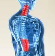 images Pour mieux comprendre la hernie discale dorsale et les solutions SIEGES KHOL